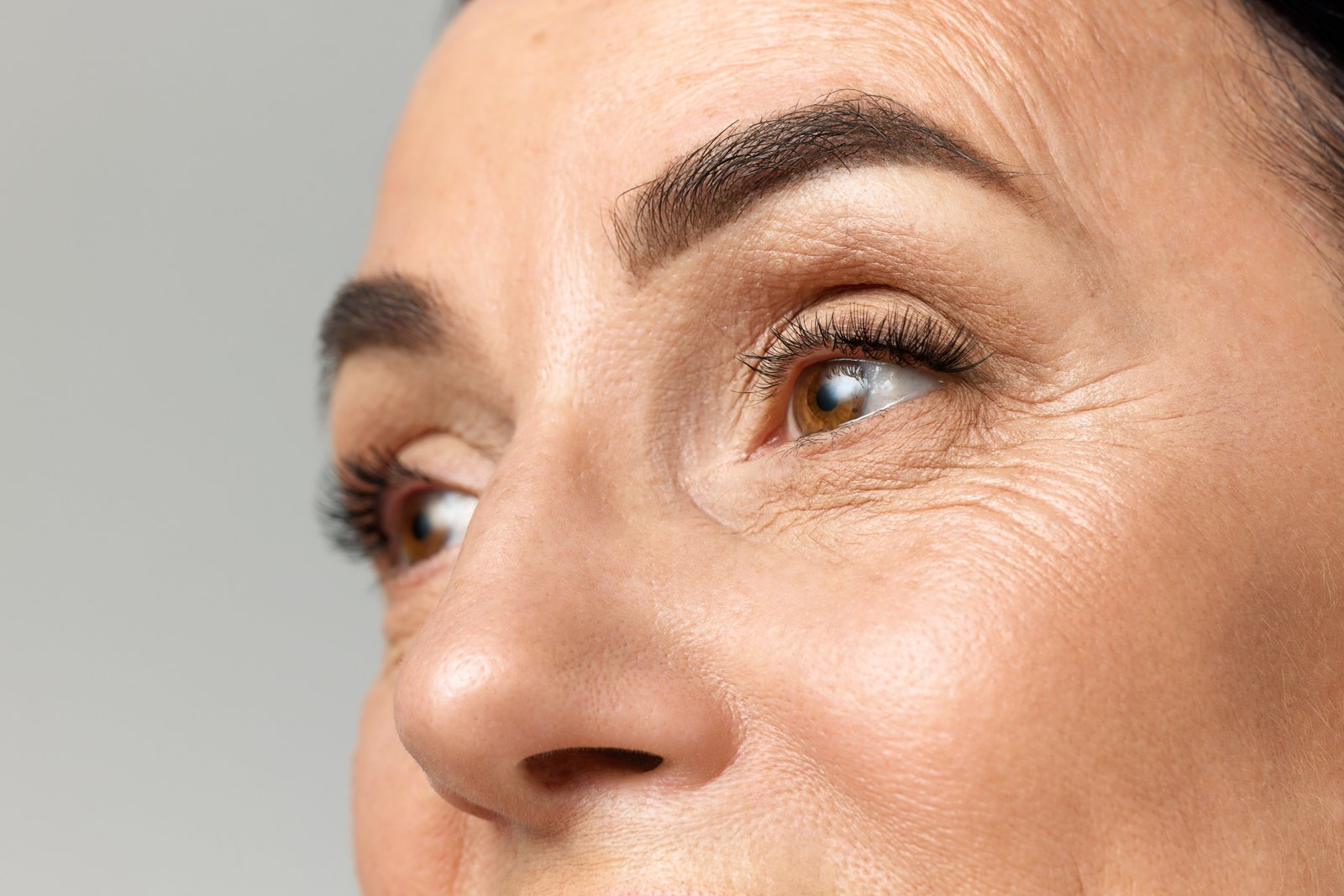 Fine lines/Wrinkles